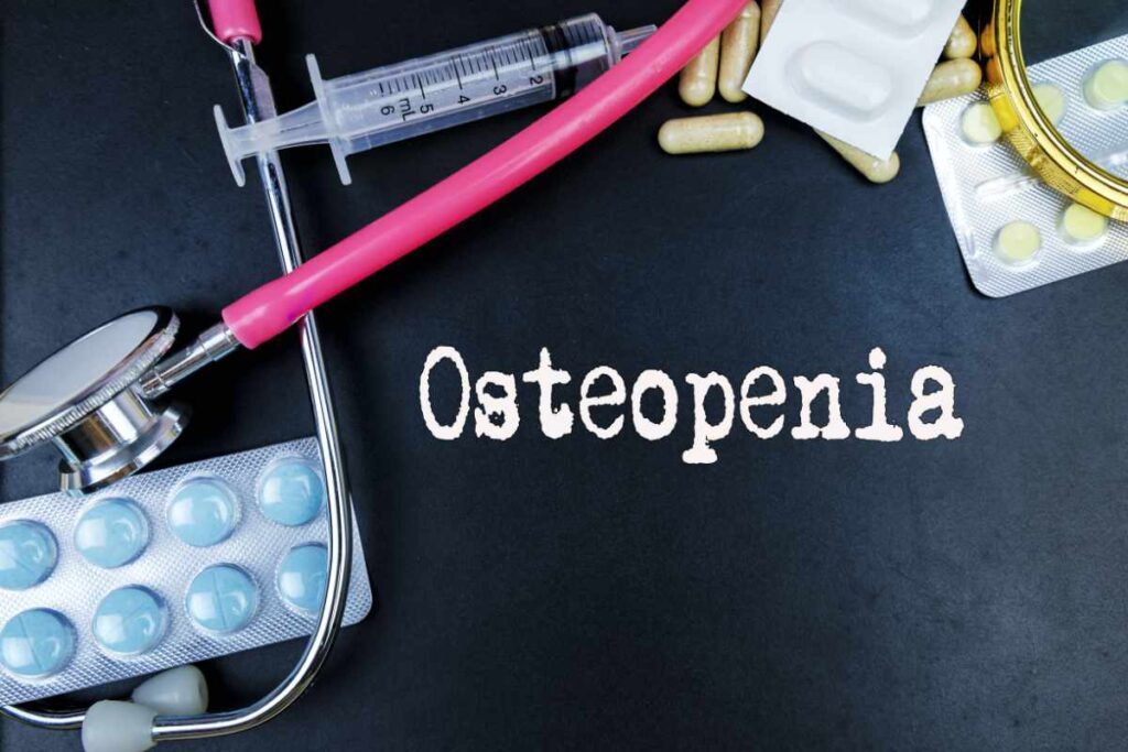 can osteopenia be reversed | can you reverse osteopenia