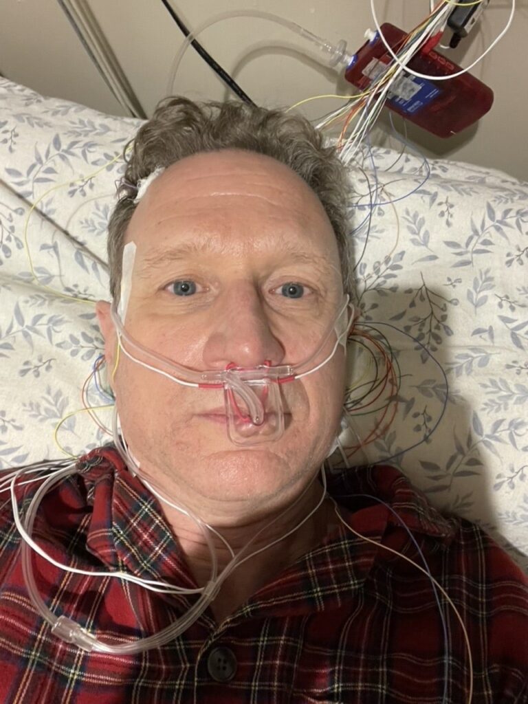 sleep study polysomnogram